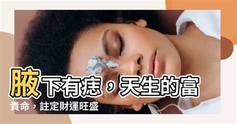 腋下有凸痣|腋下黑痣是否需除？如何處理？